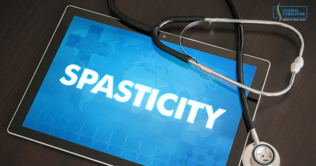 Epidural Stimulation reduces spasticity and spasms in SCI patients - Epidural Stimulation Now